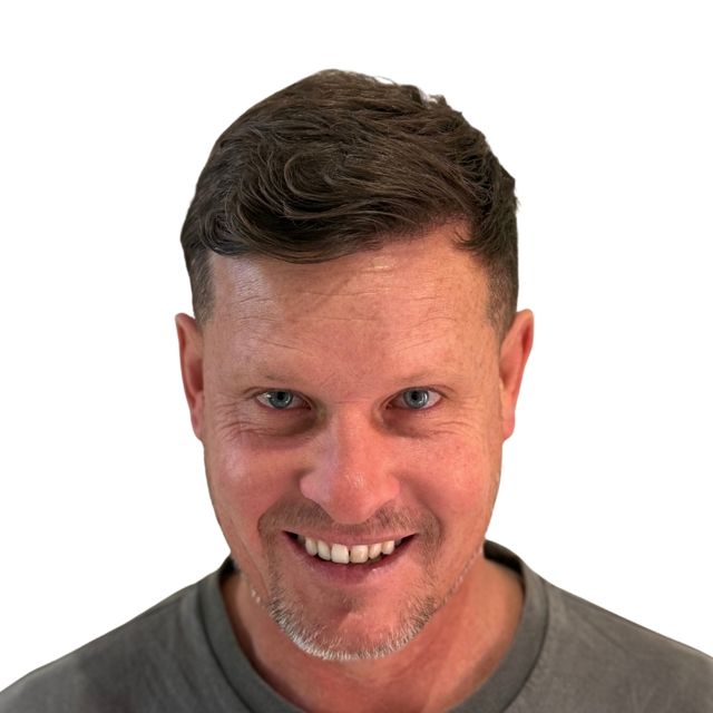 Hairline Clinic patient after hair transplant