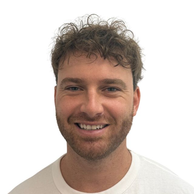 Hairline Clinic patient after hair transplant