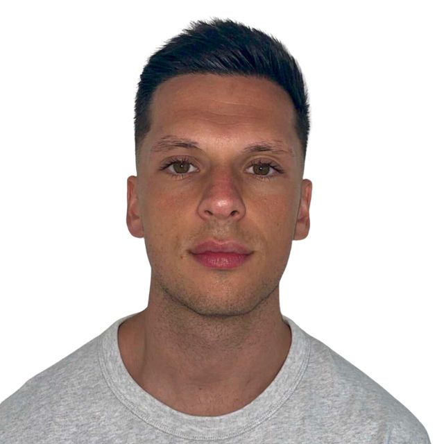 Hairline Clinic patient after hair transplant