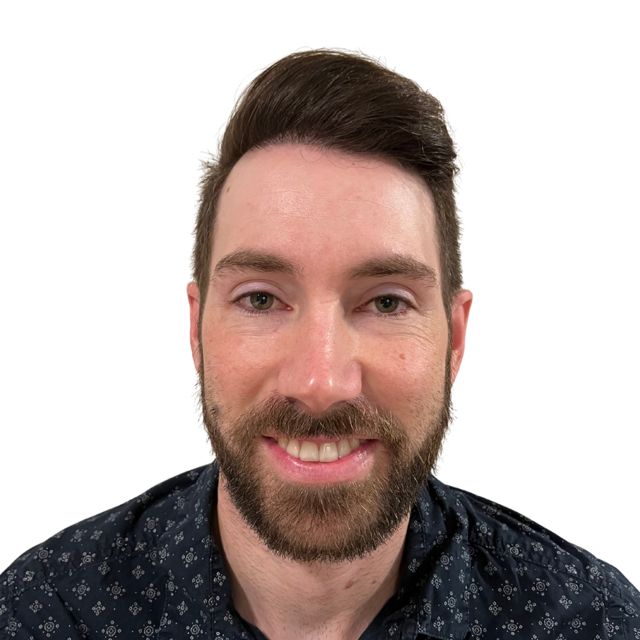 Hairline Clinic patient after hair transplant
