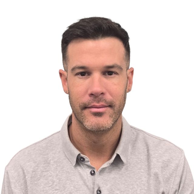 Hairline Clinic patient after hair transplant